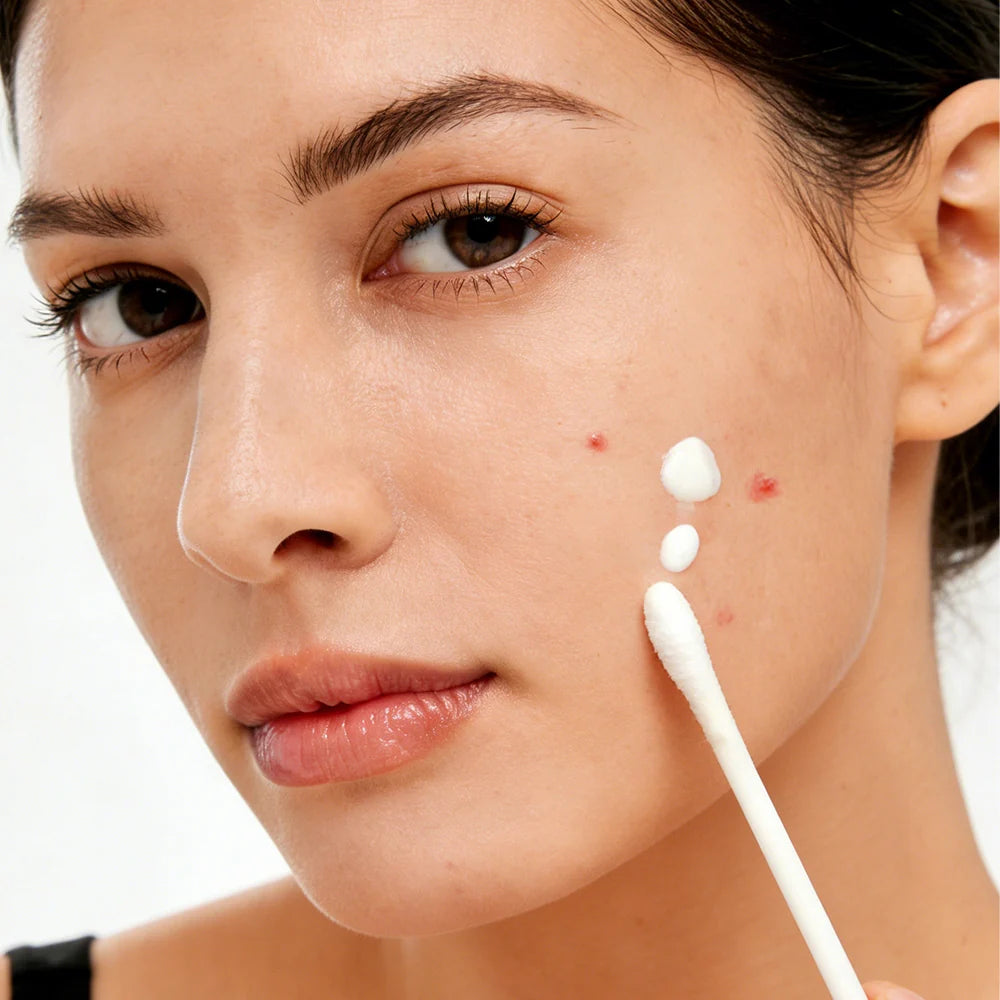 Pimple Drying Lotion